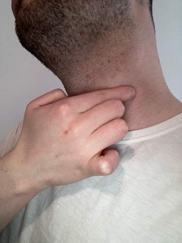 Knubbel Im Hals Gesundheit Und Medizin Knubbel Im Hals Gesundheit Und Medizin