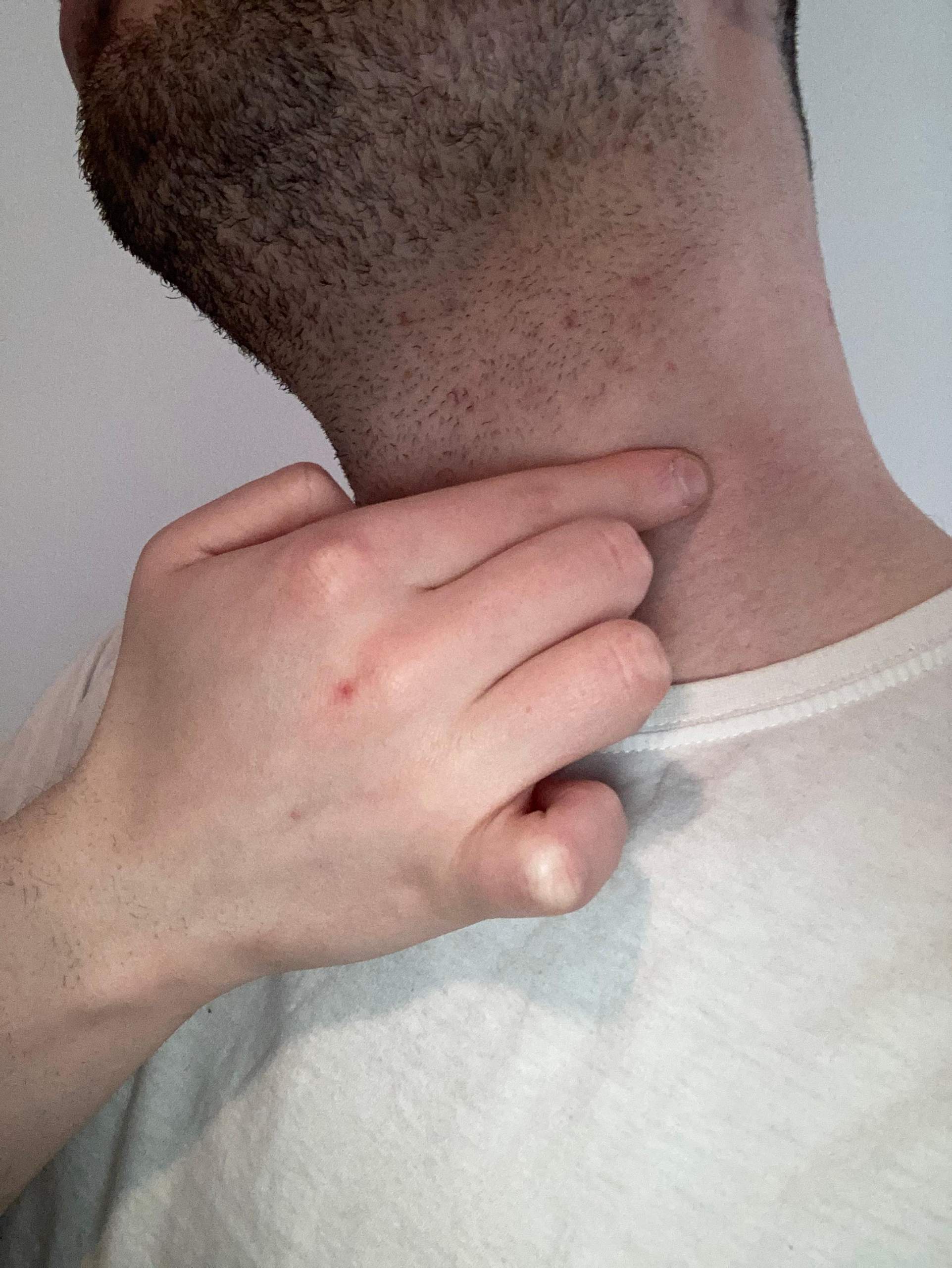 Knubbel im Hals? (Gesundheit und Medizin)