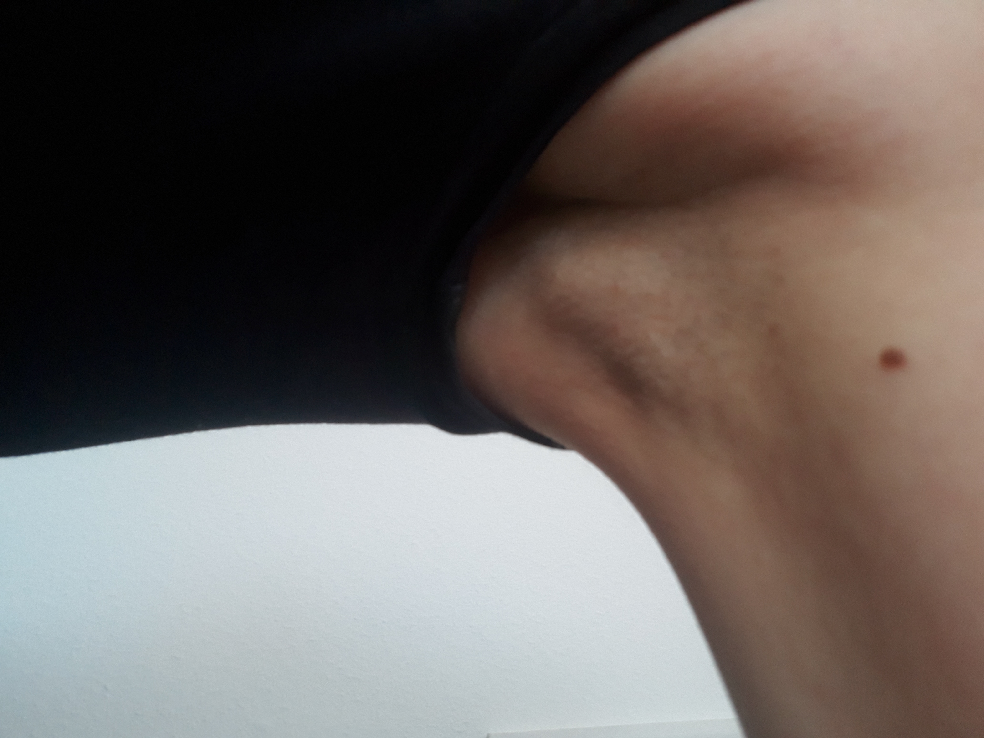 Knubbel Unter Der Linken Achsel Was Bedeutet Es Gesundheit Und Medizin Achselhoehle Knubbel Unter Der Linken Achsel Was Bedeutet Es Gesundheit Und Medizin Achselhoehle