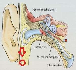 Knubbel Unter Ohr Und Druck Im Ohr Gesundheit Arzt Kiefer Knubbel Unter Ohr Und Druck Im Ohr Gesundheit Arzt Kiefer