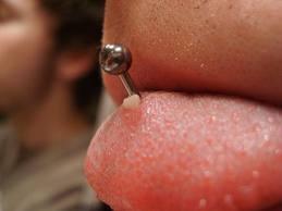 knubbel auf zunge - (Piercing, Zunge)