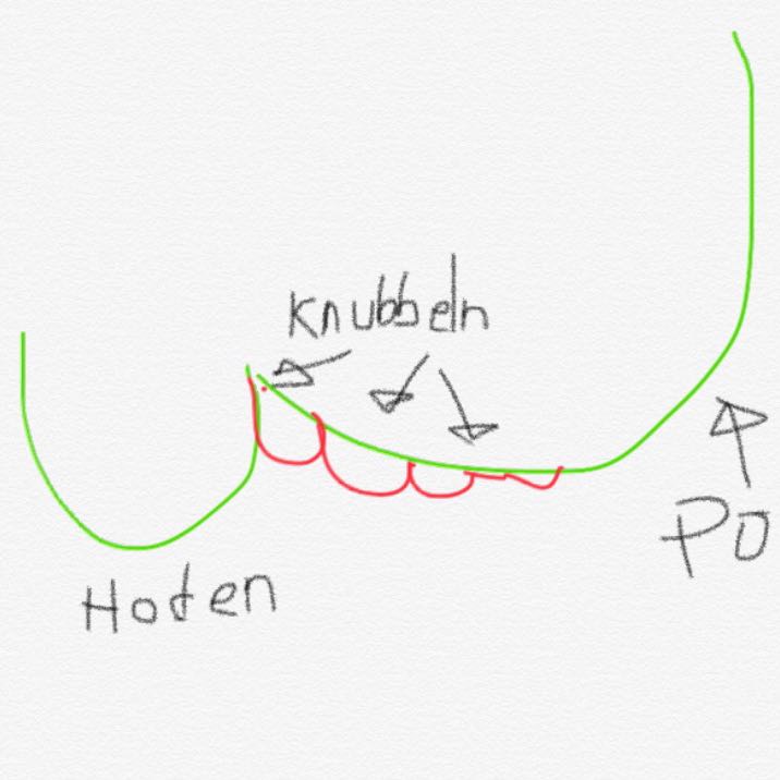 "Knubbel" zwischen Hoden und After? (Medizin, Genitalien)
