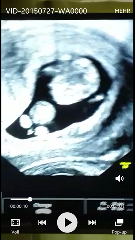 ultraschall - (Schwangerschaft, Gynäkologe, Geschlecht)