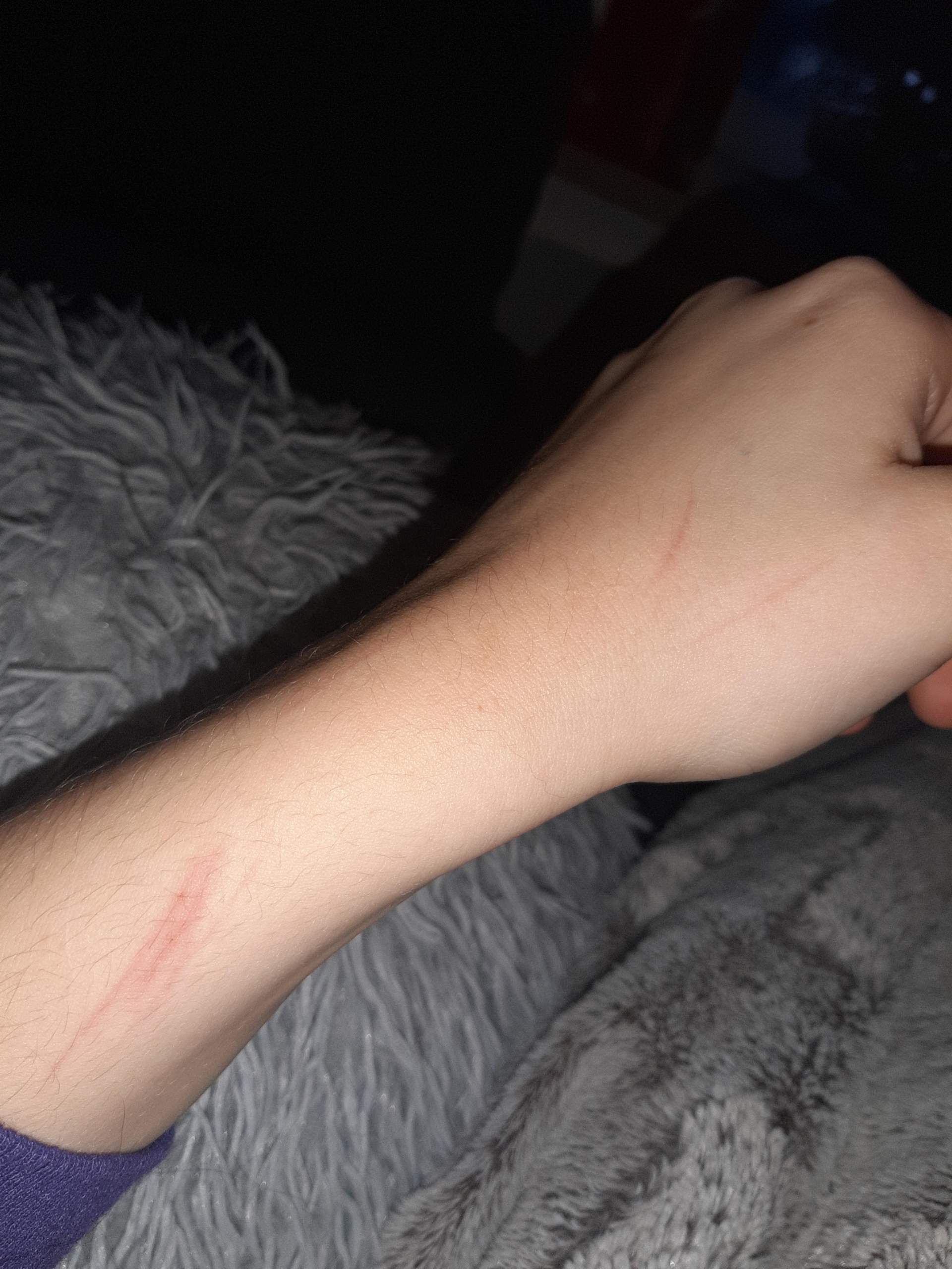 Könnte daraus eine narbe entstehen oder verheilt das wieder wenn ja wie