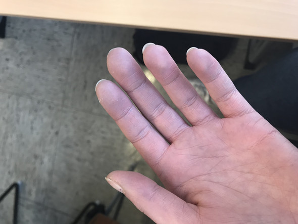 Konnte Ich Eine Durchblutungsstorung Haben Gesundheit Und Medizin Gesundheit Medizin Konnte Ich Eine Durchblutungsstorung Haben Gesundheit Und Medizin Gesundheit Medizin