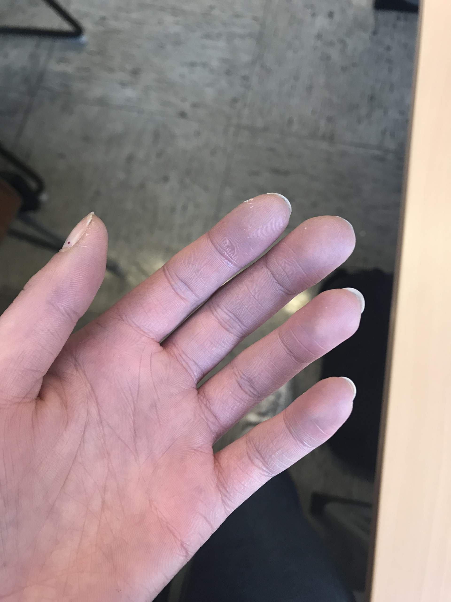 Konnte Ich Eine Durchblutungsstorung Haben Gesundheit Und Medizin Gesundheit Medizin