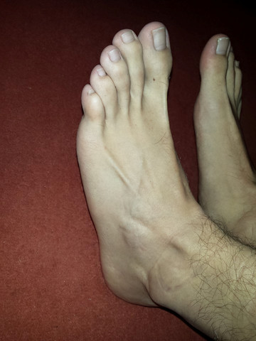 Komische Bzw Schiefe Zehen Schlimm Gesundheit Aussehen Fusse Komische Bzw Schiefe Zehen Schlimm Gesundheit Aussehen Fusse