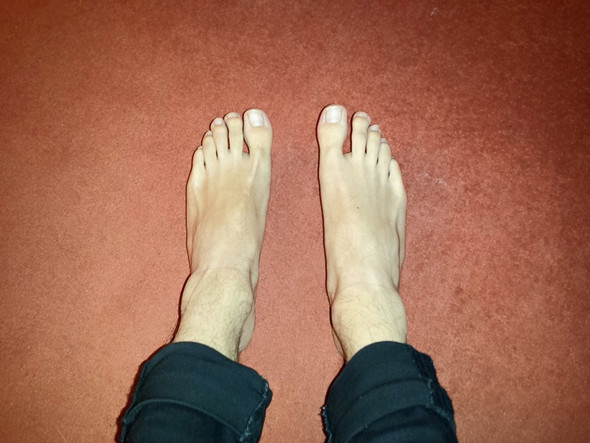 Komische bzw. schiefe Zehen. Schlimm? (Gesundheit, Aussehen, Füße)