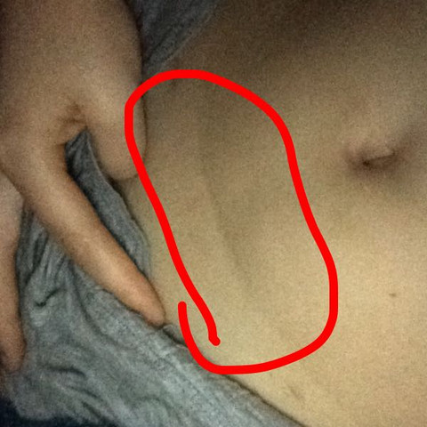 Hier ist die Falte. - (Diät, Bauch, fett)