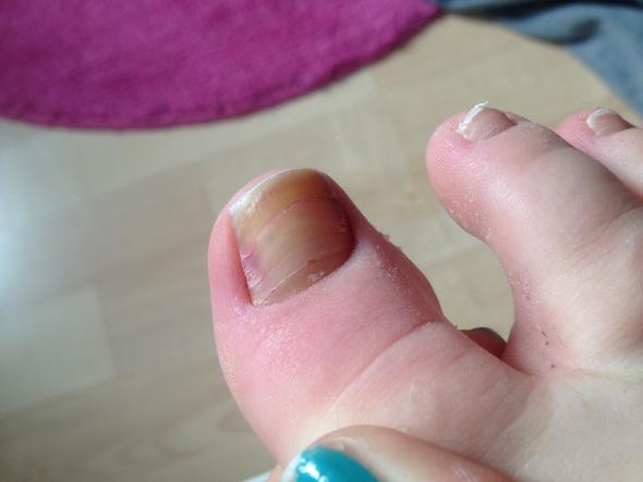 Komische Fussnagel Fusse Nagel Nagellack