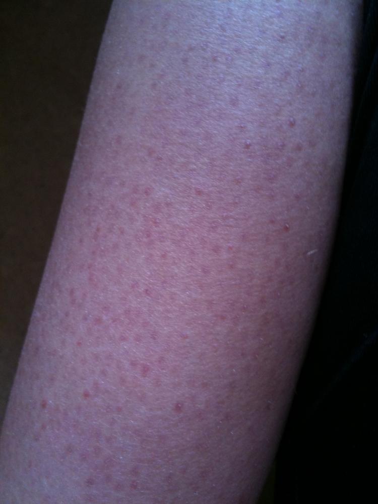 Komische Haut an den Beinen?! (Gesundheit, Medizin, Pflege)