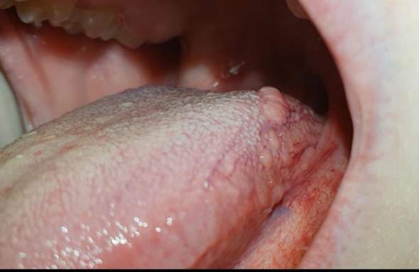 Zunge Die Meistgelesenen Fragen Zunge Die Meistgelesenen Fragen