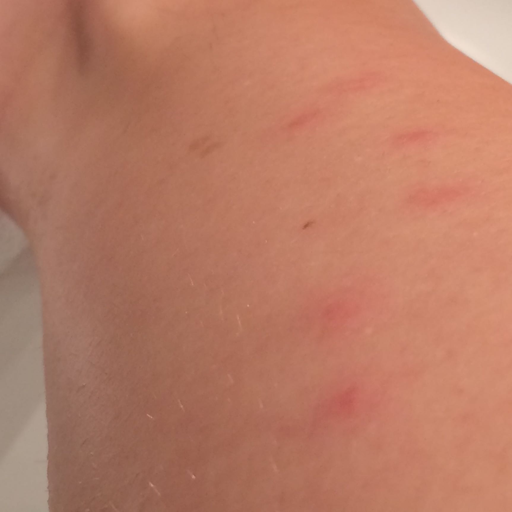 Komische juckende Stiche... Flöhe? (Medizin, Hund, Haut)