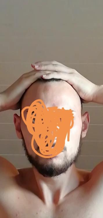 Kopfform Für Glatze
