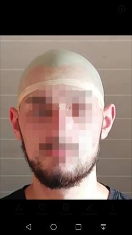 Komische Kopfform Fur Glatze Beauty Aussehen Frisur