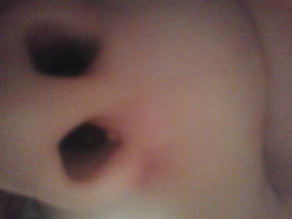 -.- - (Pickel, Nase)