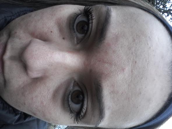 Komische Ringe Unter Den Augen Gesundheit Augenringe Komische Ringe Unter Den Augen Gesundheit Augenringe