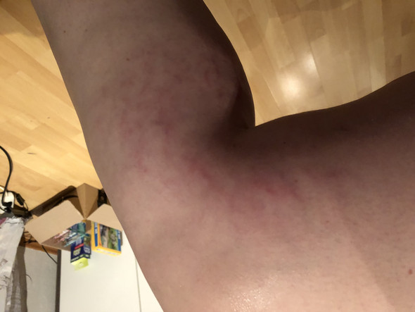 - (Gesundheit, Haut, Beine)