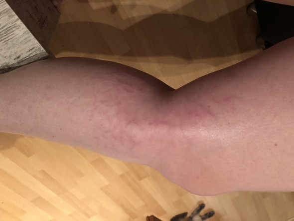 - (Gesundheit, Haut, Beine)