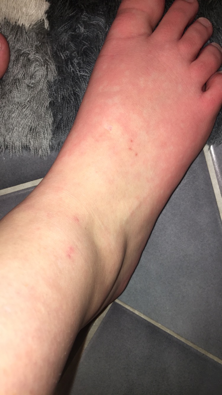 Komische Rote Fusse Nach Dem Duschen Durchblutung Komische Rote Fusse Nach Dem Duschen Durchblutung