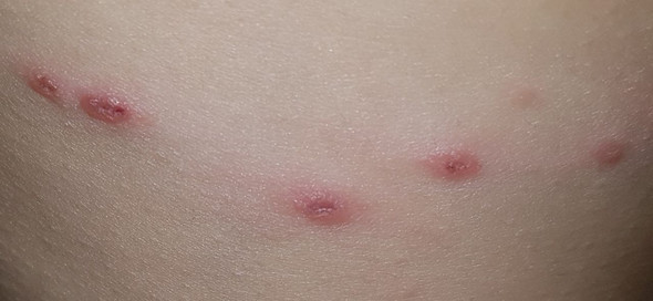 Komische Rote Punkte Am Korper An Einer Stelle Beauty Aussehen