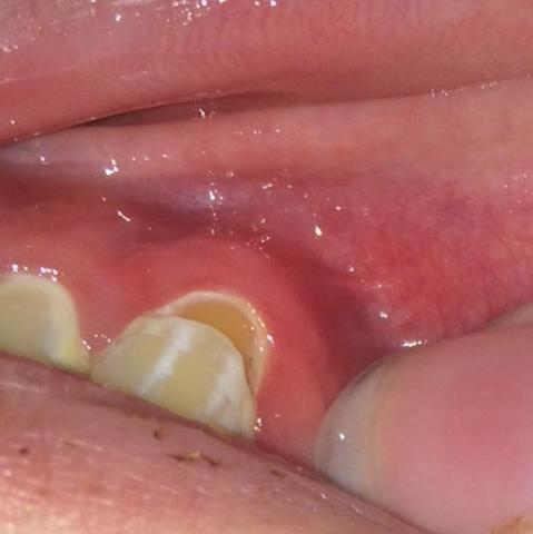 Das ist der Zahn  - (Arzt, Krankheit, Zähne)