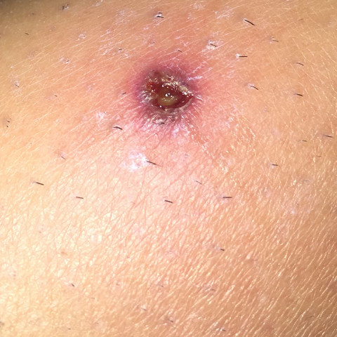 komische wunde an bein gesundheit und