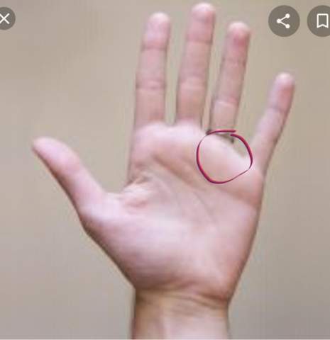 Komischen Knubbel An Der Handflache Was Konnte Das Sein Gesundheit Und Medizin Hand Komischen Knubbel An Der Handflache Was Konnte Das Sein Gesundheit Und Medizin Hand