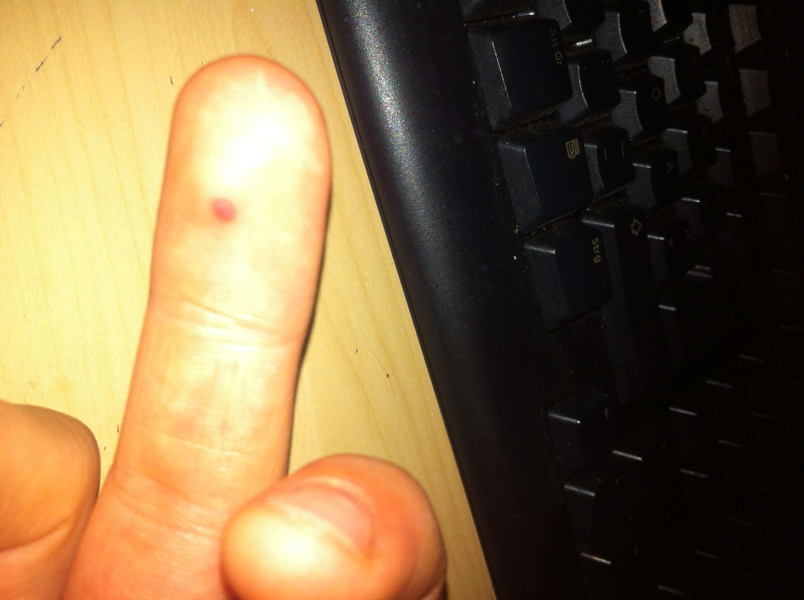 Komischer blauer Punkt unter der Haut. (Punkte)