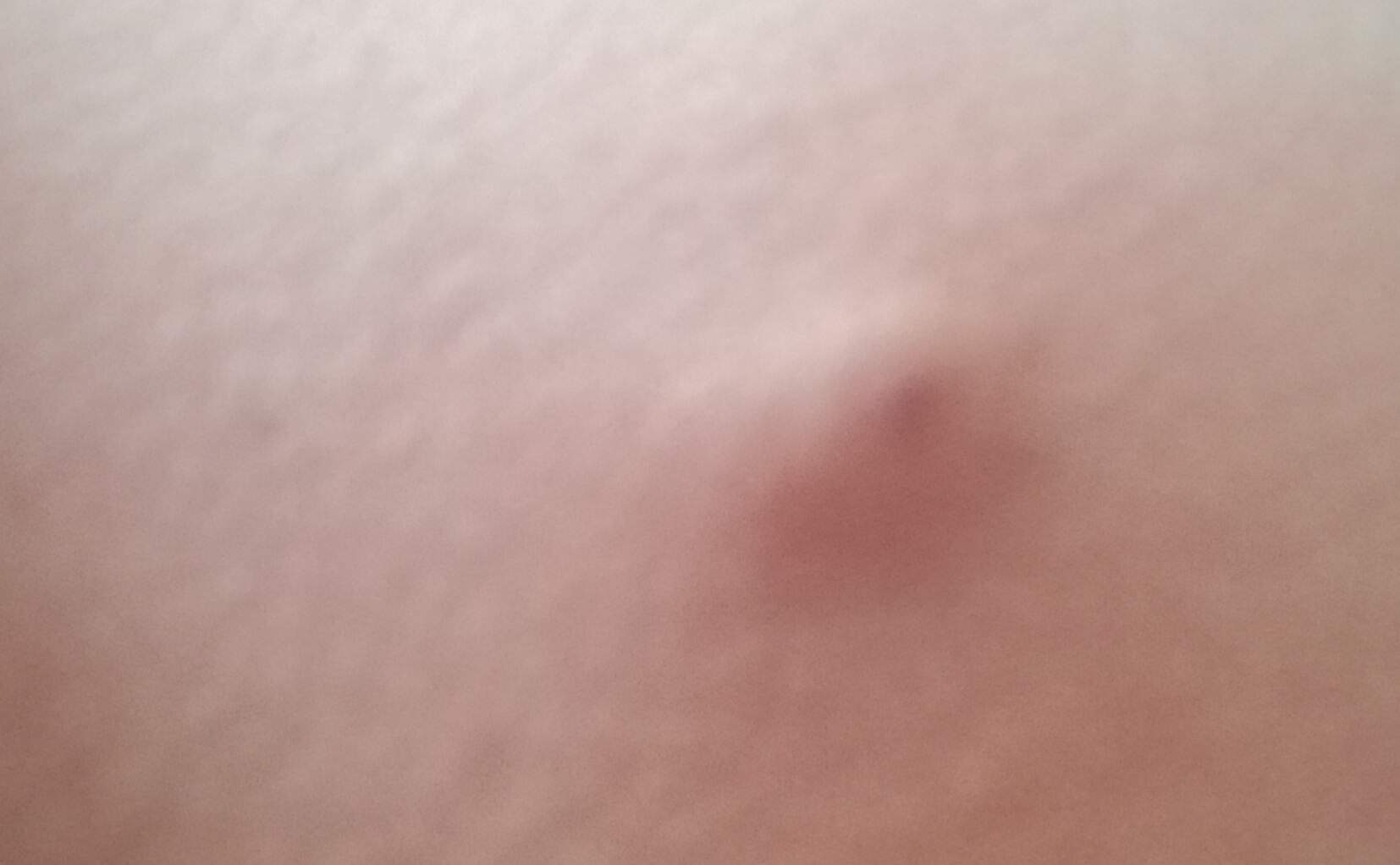 komischer pickel auf obererer brust