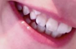 Komischer Zahn - (Zähne)