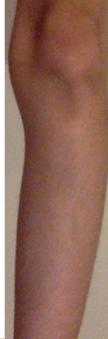 hier - (Beine, Knie, Waden)