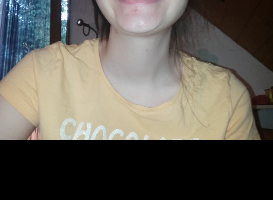 Komisches Kinn Doppelkinn Die Ursache