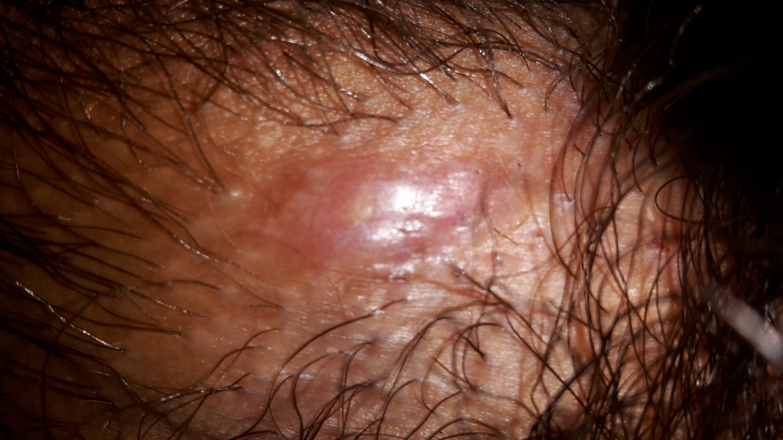 Was Tun Gegen Schnell Fettendes Haar. was tun gegen 