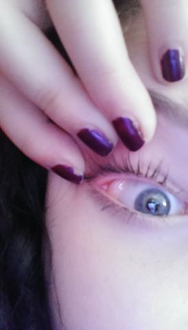 Komisches Zeug Am Auge Gesundheit Augen Komisches Zeug Am Auge Gesundheit Augen