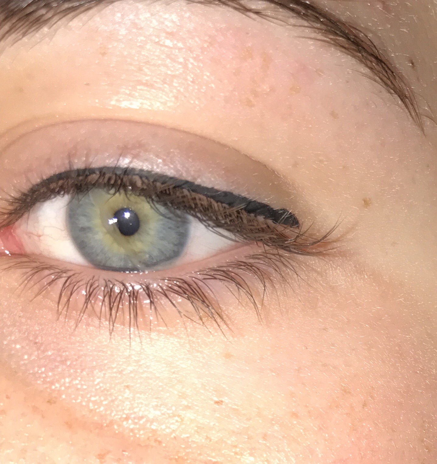 Komisches Zeugs Im Auge Morgens Gesundheit Augen Komisches Zeugs Im Auge Morgens Gesundheit Augen