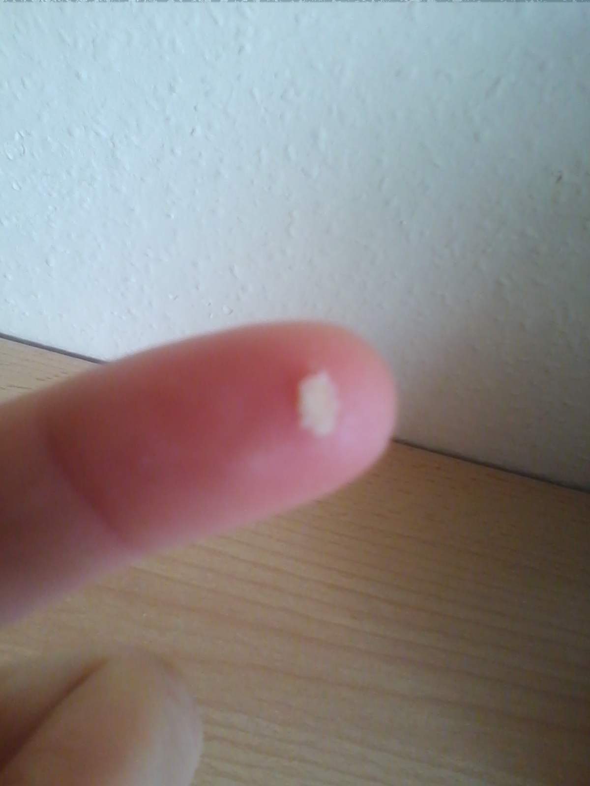 kopf kratzen rückstände? (Haare, Kopfhaut)