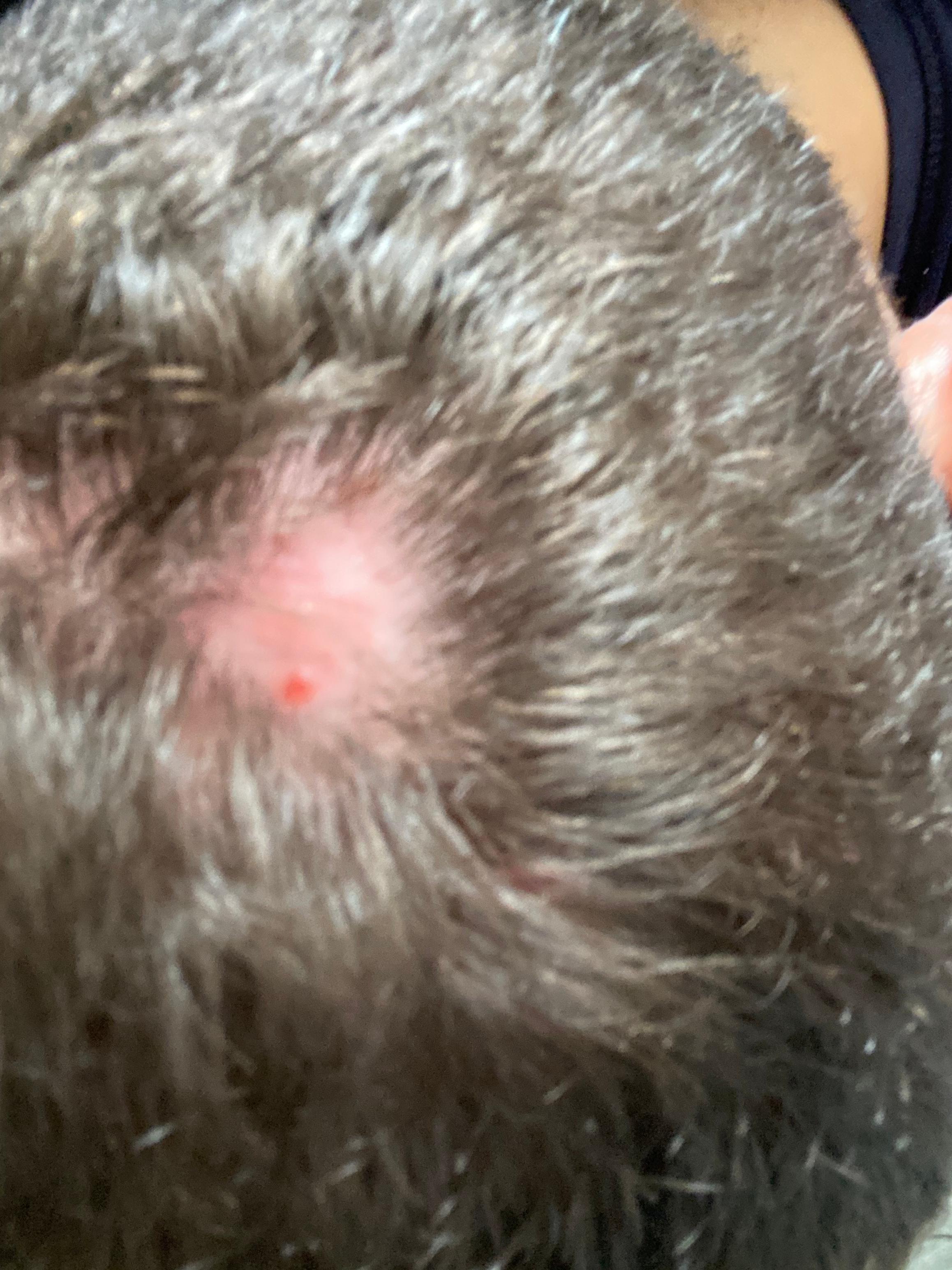 kopfhaut pickel wachsen die haare nach