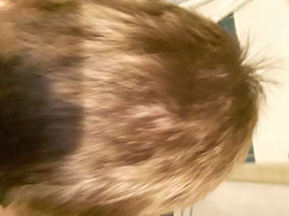 Kopfhaut Sichtbar Habe Ich Haarausfall Haare Hilflos 16 Jahre Alt