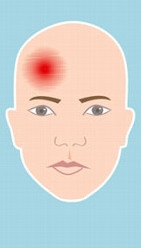 Kopfschmerzen Medizin Medikamente Kopf Kopfschmerzen Medizin Medikamente Kopf