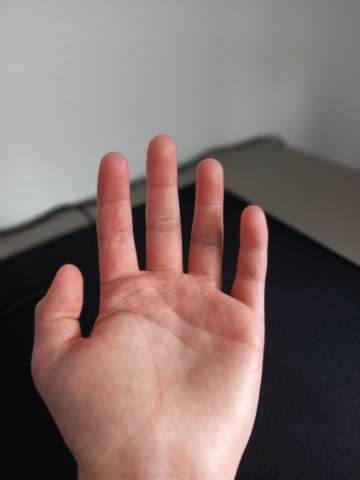 Finger verstaucht wie lange
