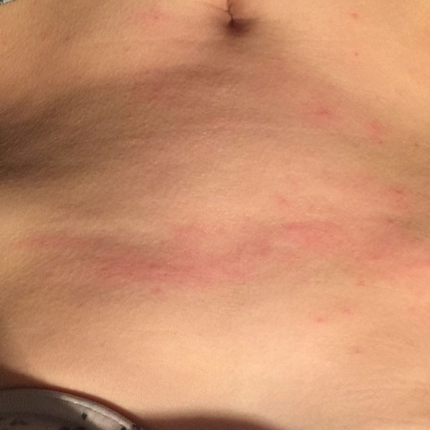 Kratze Arzte Haben Zu Darf Man Dann Ins Krankenhaus Und Sich Sonstiges Verschreiben Lassen Gesundheit Und Medizin Arzt Haut Kratze Arzte Haben Zu Darf Man Dann Ins Krankenhaus Und Sich Sonstiges Verschreiben Lassen Gesundheit Und Medizin Arzt Haut