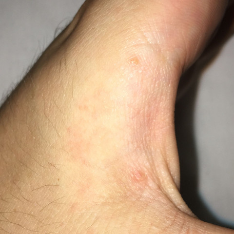 Kratze Das Ewige Jucken Wegbekommen Gesundheit Und Medizin Arzt Dermatologie Kratze Das Ewige Jucken Wegbekommen Gesundheit Und Medizin Arzt Dermatologie