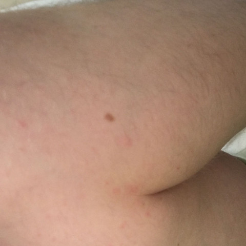Kratze Das Ewige Jucken Wegbekommen Gesundheit Und Medizin Arzt Dermatologie Kratze Das Ewige Jucken Wegbekommen Gesundheit Und Medizin Arzt Dermatologie