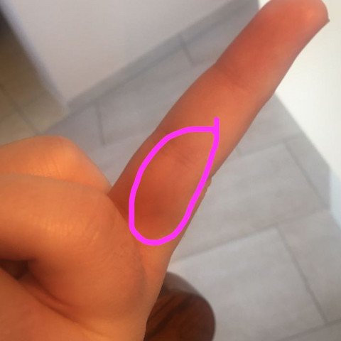 Man kann es leider nicht so gut erkennen auf dem foto - (Gesundheit und Medizin, Medizin, Hand)