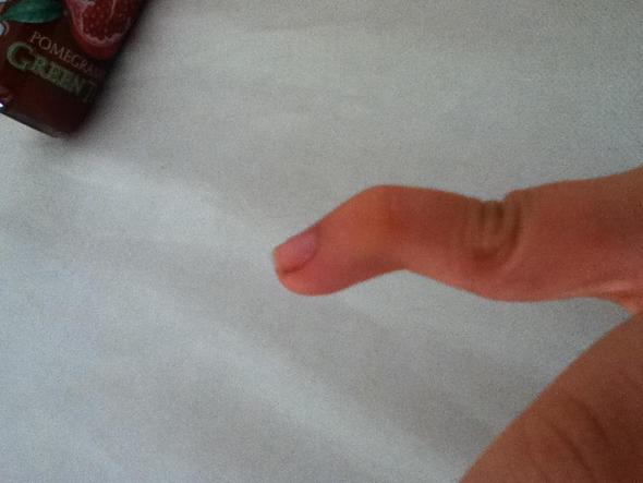 Der kleinste Finger ist der schlimmste - (Gesundheit, Arzt, Finger)
