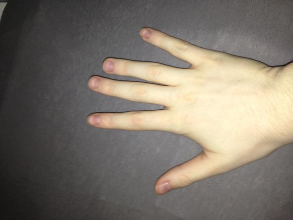 - (Finger, knacken, krumm)