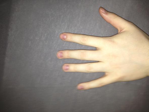- (Finger, knacken, krumm)