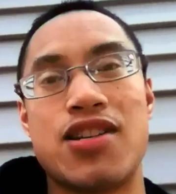 Kurzsichtigkeit Steigt Und Steigt Und Steigt Bosartig Gesundheit Brille Myopie