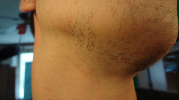 Lasse Mir Bart Stehen Schock Kleine Kahle Stelle Was Tun Bartwuchs Lasse Mir Bart Stehen Schock Kleine Kahle Stelle Was Tun Bartwuchs